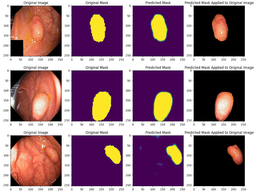 Segmentation Project