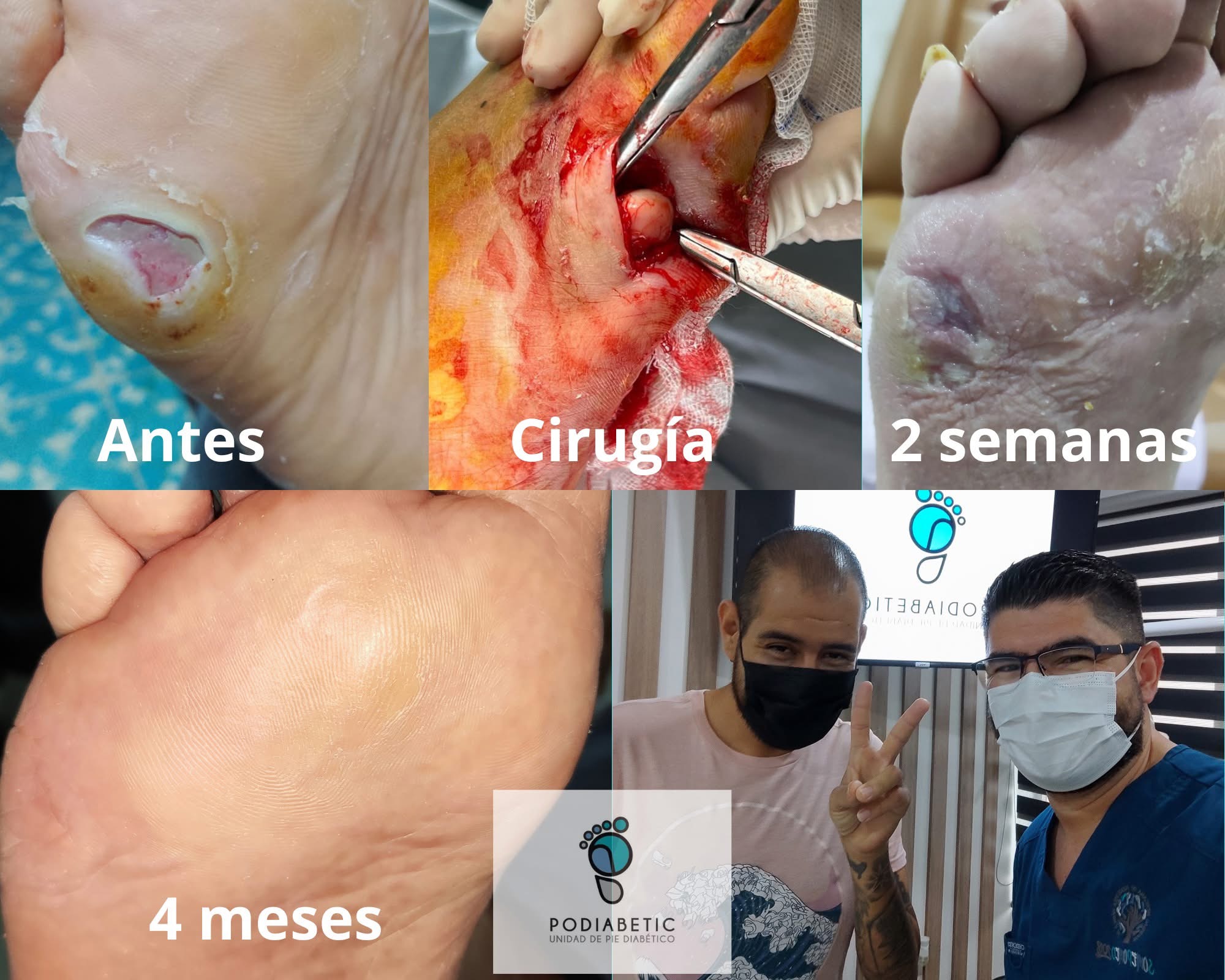Podiabetic: cirugías y cursos de capacitación médica