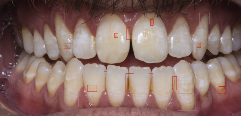 Fig 6