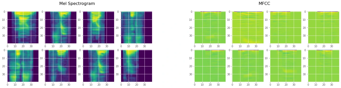 Mel Spectrogram vs MFCC (Split)