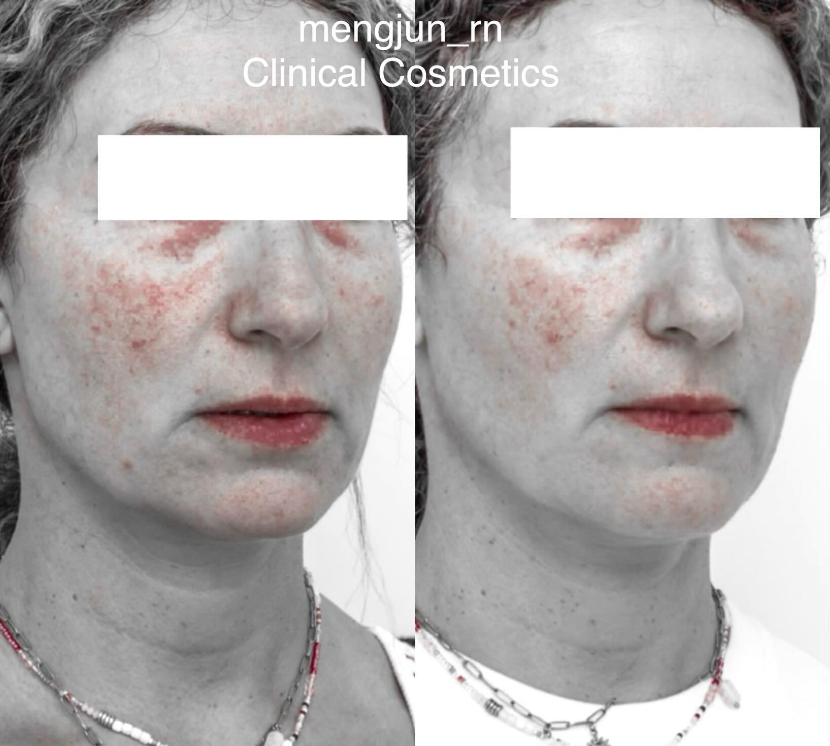 Case 27