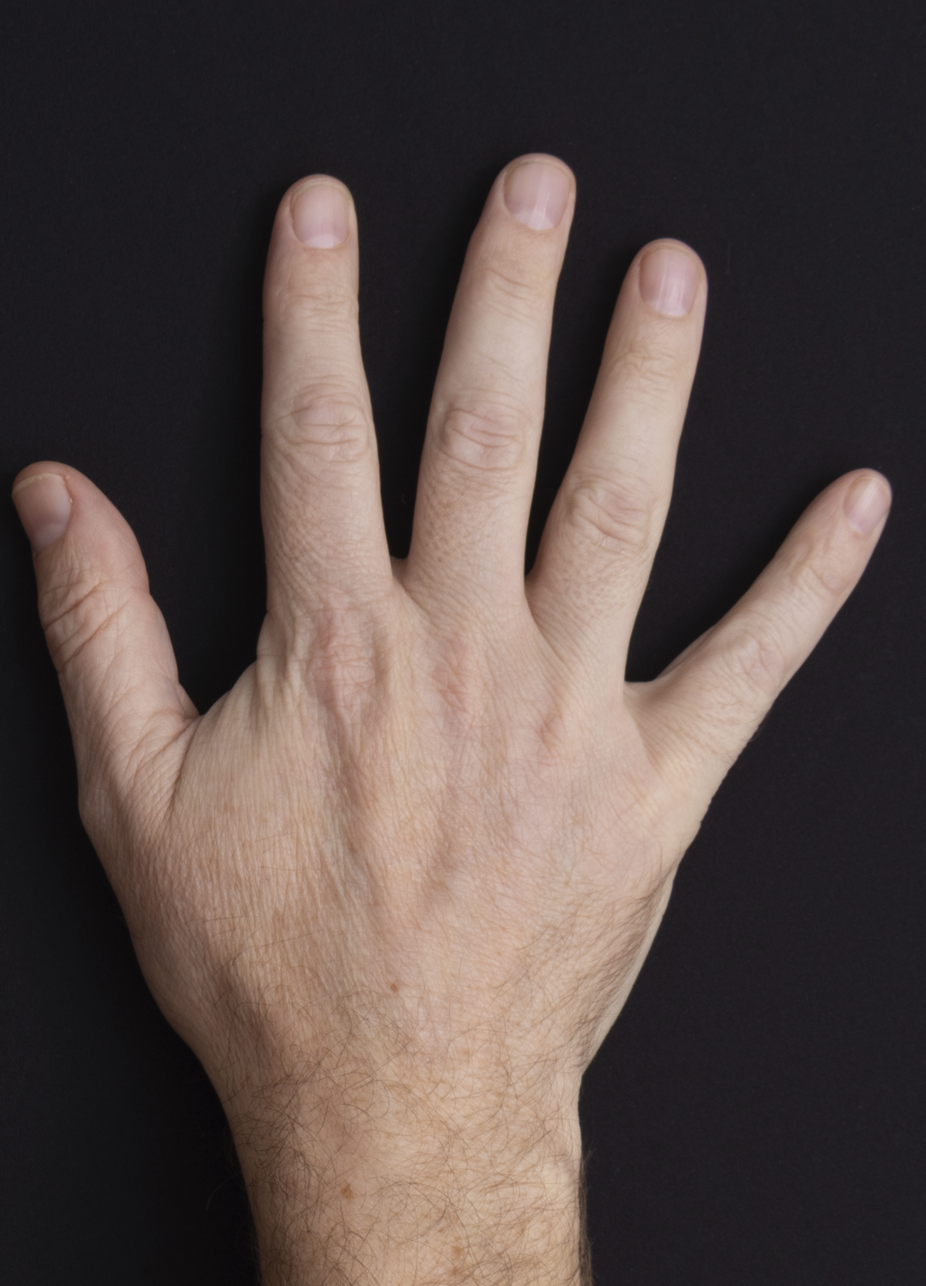 Hands