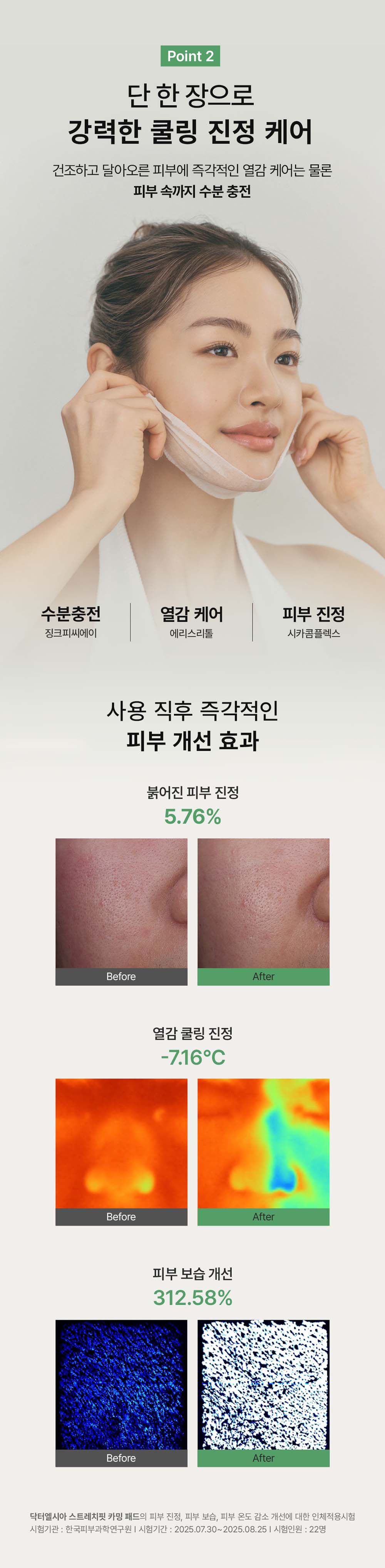 스트레치핏 5