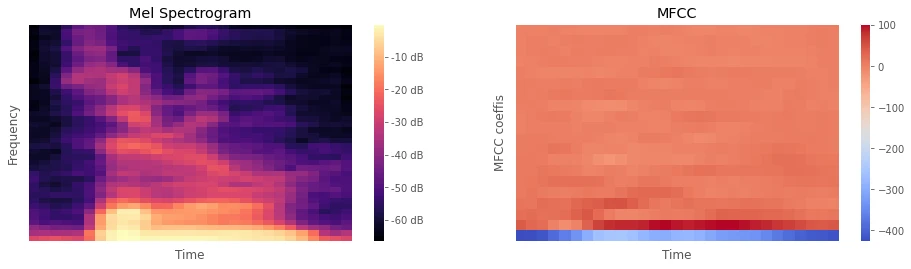 Mel Spectrogram vs MFCC