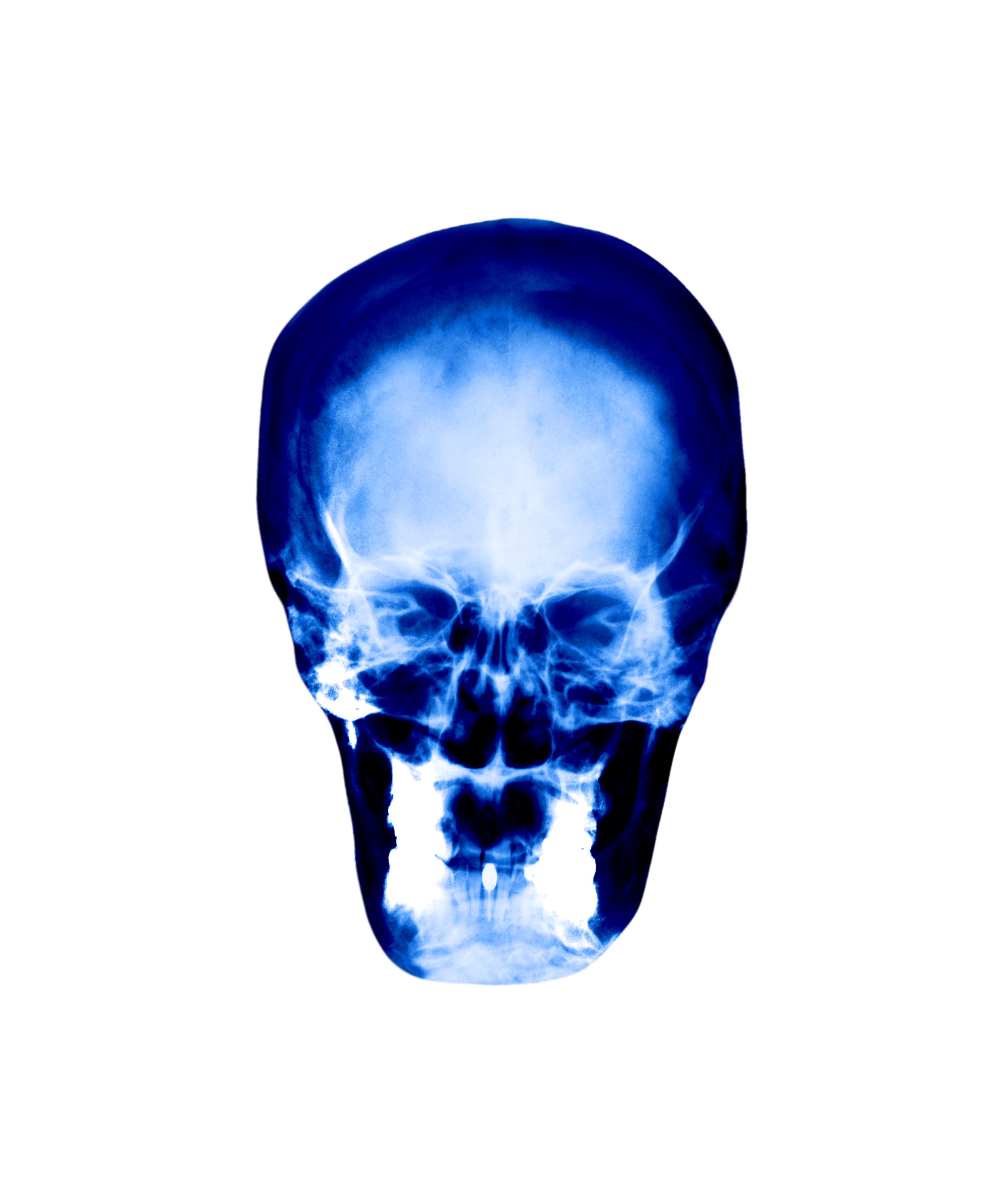 The Catalyst 7