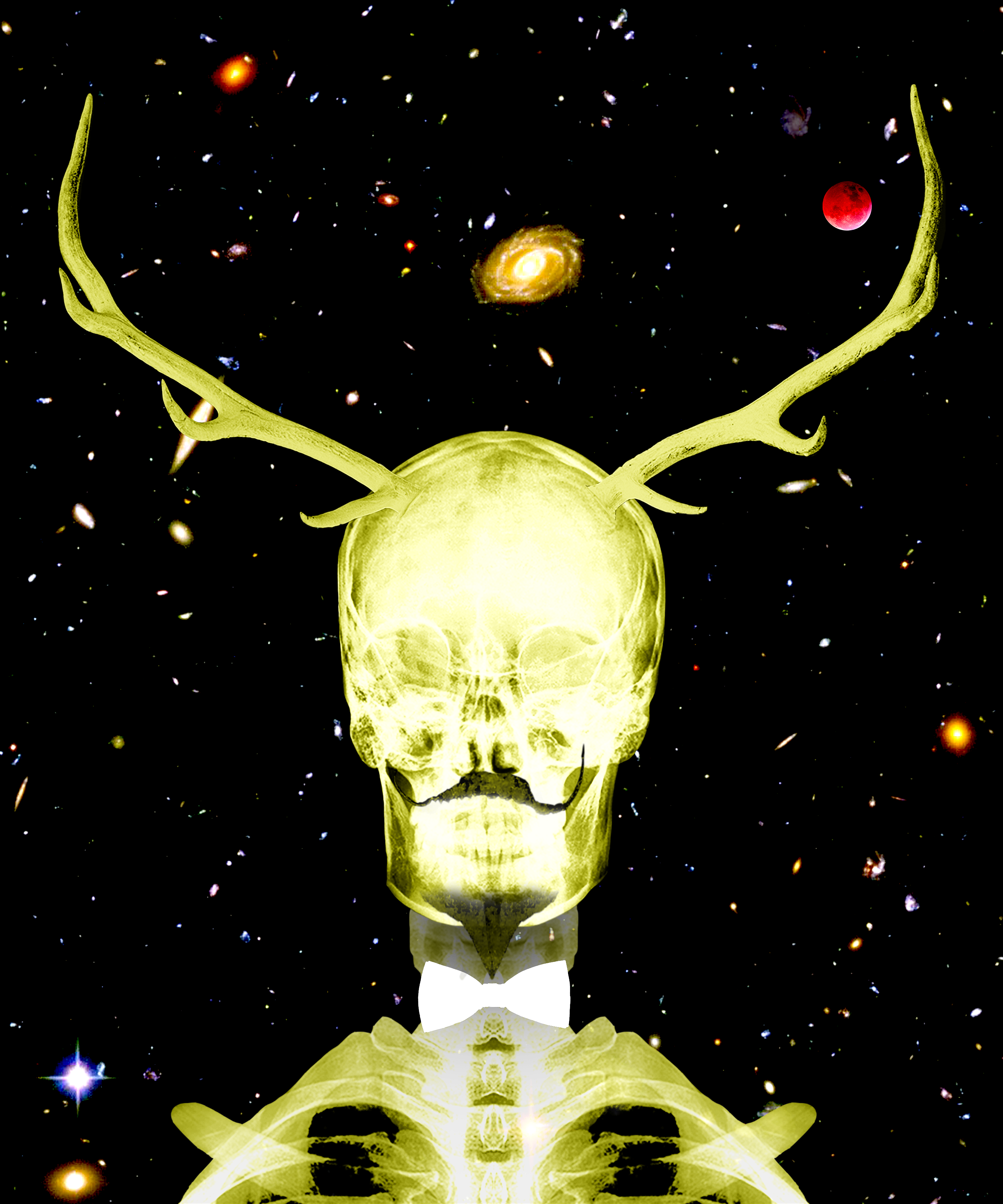 The Trophy 3