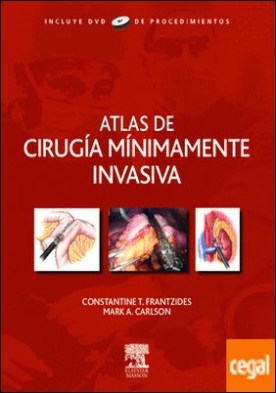 Atlas de cirugía mínimamente invasiva + DVD-ROM